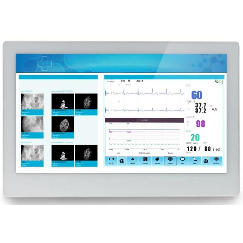 ADLINK MLC 5-21HE Medical AIO i7-5700EQ/8GB/128GB SSD *TouchScreen* *No Stand* - Refurbished Grade A Repainted - 2 ΕΤΗ ΕΓΓΥΗΣΗ