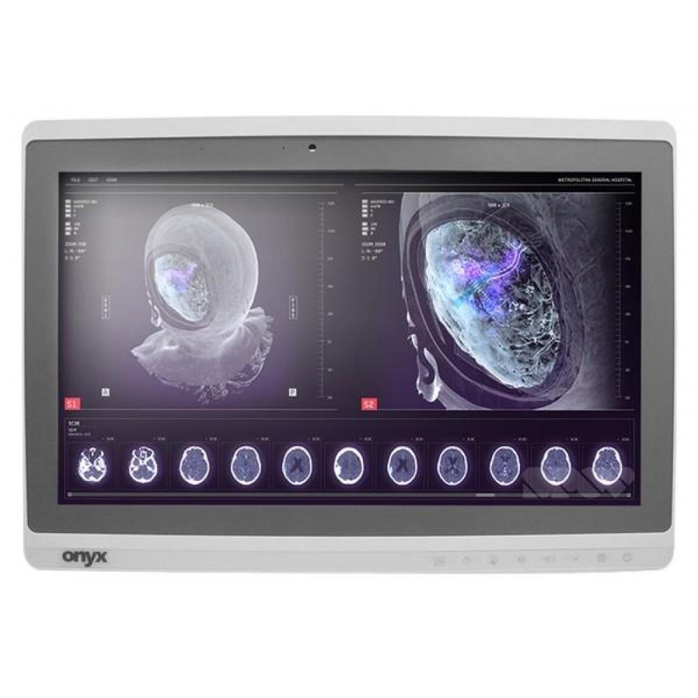 Onyx-Zeus-248 Professional Medical AIO i7-6500U/8GB/250GB SSD *TouchScreen* *No Stand* - Refurbished Grade A Repainted - 2 ΕΤΗ ΕΓΓΥΗΣΗ Onyx-Zeus-248 Professional Medical AIO i7-6500U/8GB/250GB SSD *TouchScreen* *No Stand* - Refurbished Grade A Repainted - 2 ΕΤΗ ΕΓΓΥΗΣΗ