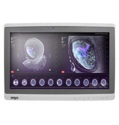 Onyx-Zeus-248 Professional Medical AIO i7-6500U/8GB/250GB SSD *TouchScreen* *No Stand* - Refurbished Grade A Repainted - 2 ΕΤΗ ΕΓΓΥΗΣΗ